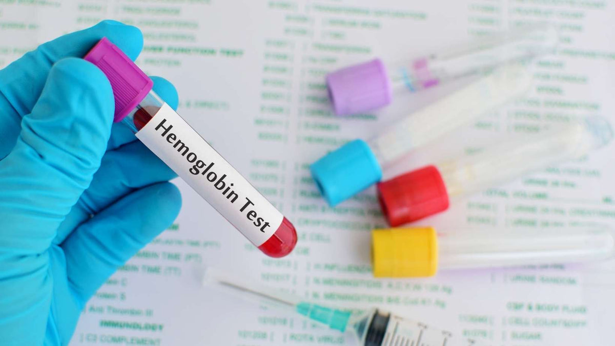 Hemoglobin Test For Results Medasia Store Anemia Blog   2 1adf25a4 Aa43 4343 892f 741140a1ae3b 1200x1200 