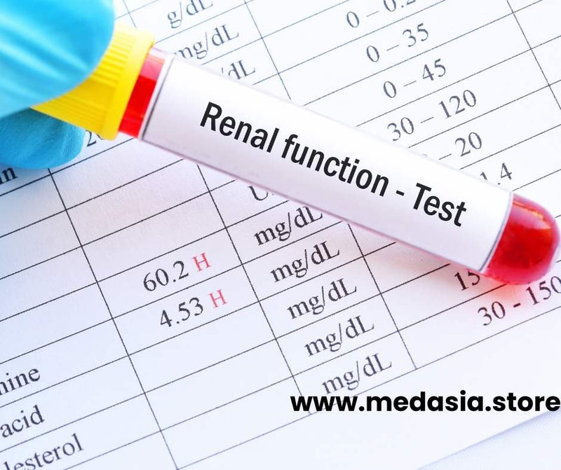 Buy Uric Acid Gout and Kidney Stones Home Testing & Self-Test Kits